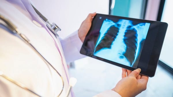 Tuberculosis cases detected in the Murraylands